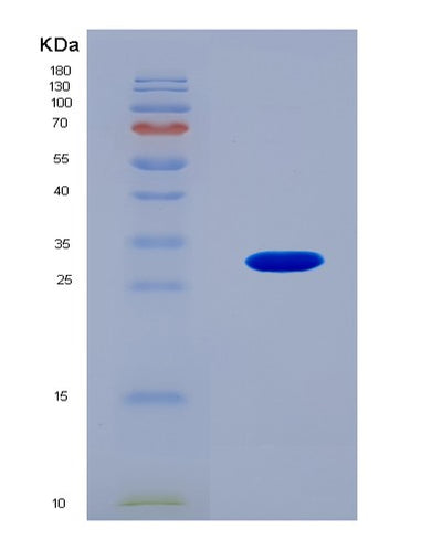 SDS-PAGE analysis of Human AIFM1 (Apoptosis-Inducing Factor 1, Mitochondrial) - Recombinant Protein, CAT# BLT-08243P, showing >90% purity under 15% SDS-PAGE (Reduced)Human AIFM1 (Apoptosis-Inducing Factor 1, Mitochondrial) - Recombinant Protein
