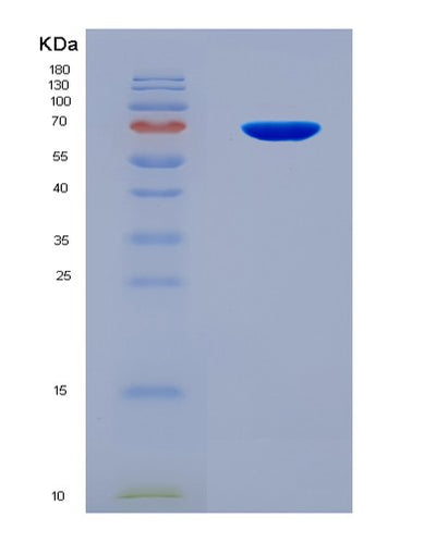 SDS-PAGE analysis of Mouse Igf2bp3 (Insulin-Like Growth Factor 2 Mrna-Binding Protein 3) - Recombinant Protein, CAT# BLT-08244P, showing >90% purity under 15% SDS-PAGE (Reduced)Mouse Igf2bp3 (Insulin-Like Growth Factor 2 Mrna-Binding Protein 3) - Recombinant Protein