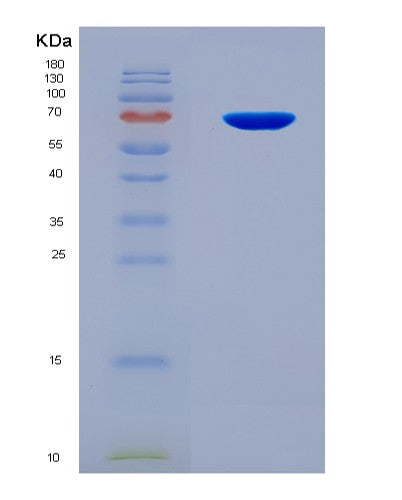 SDS-PAGE analysis of Mouse Igf2bp3 (Insulin-Like Growth Factor 2 Mrna-Binding Protein 3) - Recombinant Protein, CATMouse Igf2bp3 (Insulin-Like Growth Factor 2 Mrna-Binding Protein 3) - Recombinant Protein