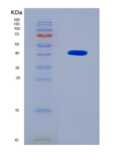 SDS-PAGE analysis of Human ASNS (Asparagine Synthetase [Glutamine-Hydrolyzing]) - Recombinant Protein, CAT# BLT-08248P, showing >90% purity under 15% SDS-PAGE (Reduced)Human ASNS (Asparagine Synthetase [Glutamine-Hydrolyzing]) - Recombinant Protein