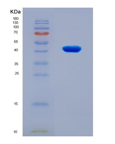 SDS-PAGE analysis of Mouse Asns (Asparagine Synthetase [Glutamine-Hydrolyzing]) - Recombinant Protein, CAT# BLT-08249P, showing >90% purity under 15% SDS-PAGE (Reduced)Mouse Asns (Asparagine Synthetase [Glutamine-Hydrolyzing]) - Recombinant Protein