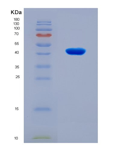 SDS-PAGE analysis of Mouse Asns (Asparagine Synthetase [Glutamine-Hydrolyzing]) - Recombinant Protein, CATMouse Asns (Asparagine Synthetase [Glutamine-Hydrolyzing]) - Recombinant Protein