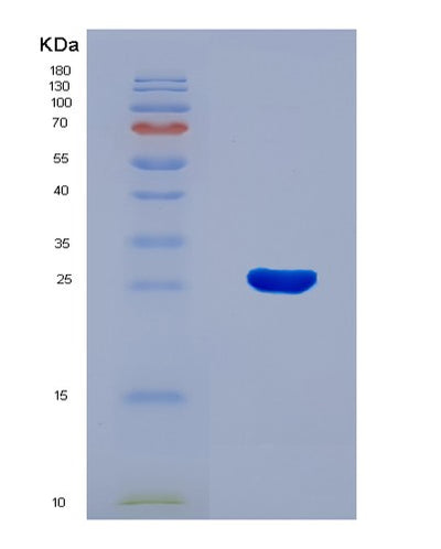 SDS-PAGE analysis of Human AMELX (Amelogenin, X Isoform) - Recombinant Protein, CAT# BLT-08250P, showing >90% purity under 15% SDS-PAGE (Reduced)Human AMELX (Amelogenin, X Isoform) - Recombinant Protein