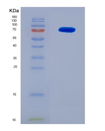 SDS-PAGE analysis of Human PKM (Pyruvate Kinase Pkm) - Recombinant Protein, CAT# BLT-08252P, showing >90% purity under 15% SDS-PAGE (Reduced)Human PKM (Pyruvate Kinase Pkm) - Recombinant Protein