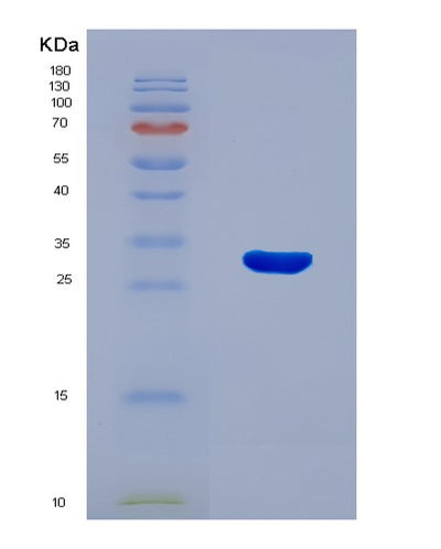 SDS-PAGE analysis of Human HIF1A (Hypoxia-Inducible Factor 1-Alpha) - Recombinant Protein, CAT# BLT-08254P, showing >90% purity under 15% SDS-PAGE (Reduced)Human HIF1A (Hypoxia-Inducible Factor 1-Alpha) - Recombinant Protein