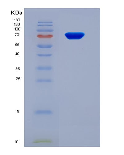 SDS-PAGE analysis of Human PCYOX1 (Prenylcysteine Oxidase 1) - Recombinant Protein, CAT# BLT-08255P, showing >90% purity under 15% SDS-PAGE (Reduced)Human PCYOX1 (Prenylcysteine Oxidase 1) - Recombinant Protein