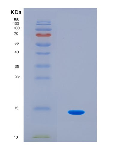 SDS-PAGE analysis of Human DVL2 (Segment Polarity Protein Dishevelled Homolog Dvl-2) - Recombinant Protein, CAT# BLT-08256P, showing >90% purity under 15% SDS-PAGE (Reduced)Human DVL2 (Segment Polarity Protein Dishevelled Homolog Dvl-2) - Recombinant Protein