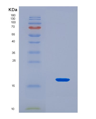 SDS-PAGE analysis of Human IL15 (Interleukin-15) - Recombinant Protein, CATHuman IL15 (Interleukin-15) - Recombinant Protein
