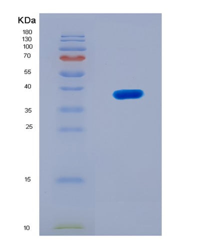SDS-PAGE analysis of Human MT2A (Metallothionein-2) - Recombinant Protein, CAT# BLT-08261P, showing >90% purity under 15% SDS-PAGE (Reduced)Human MT2A (Metallothionein-2) - Recombinant Protein
