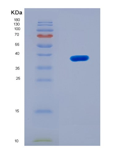SDS-PAGE analysis of Human MT2A (Metallothionein-2) - Recombinant Protein, CATHuman MT2A (Metallothionein-2) - Recombinant Protein