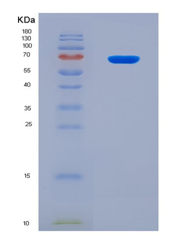SDS-PAGE analysis of Human CAPN5 (Calpain-5) - Recombinant Protein, CAT# BLT-08264P, showing >90% purity under 15% SDS-PAGE (Reduced)Human CAPN5 (Calpain-5) - Recombinant Protein