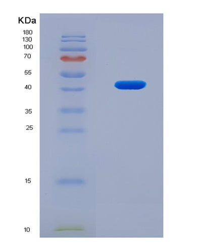 SDS-PAGE analysis of Human MMP9 (Matrix Metalloproteinase-9) - Recombinant Protein, CAT# BLT-08265P, showing >90% purity under 15% SDS-PAGE (Reduced)Human MMP9 (Matrix Metalloproteinase-9) - Recombinant Protein