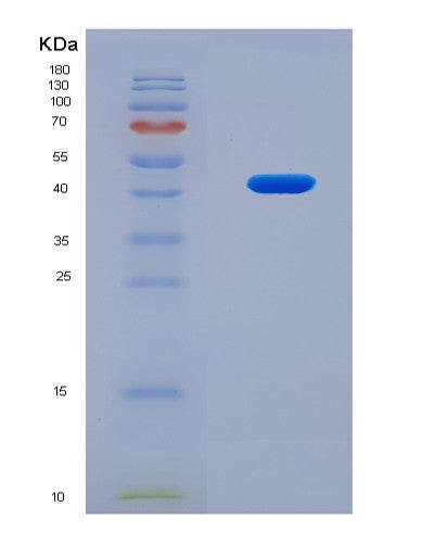 SDS-PAGE analysis of Human MMP9 (Matrix Metalloproteinase-9) - Recombinant Protein, CATHuman MMP9 (Matrix Metalloproteinase-9) - Recombinant Protein