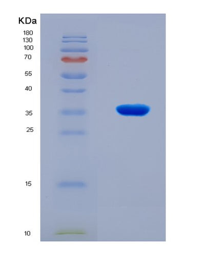 SDS-PAGE analysis of Human PRKDC (Dna-Dependent Protein Kinase Catalytic Subunit) - Recombinant Protein, CAT# BLT-08266P, showing >90% purity under 15% SDS-PAGE (Reduced)Human PRKDC (Dna-Dependent Protein Kinase Catalytic Subunit) - Recombinant Protein