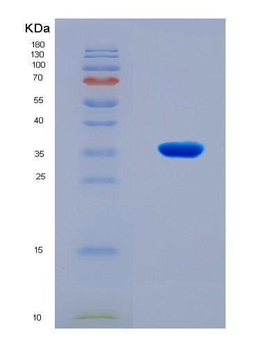 SDS-PAGE analysis of Human PRKDC (Dna-Dependent Protein Kinase Catalytic Subunit) - Recombinant Protein, CATHuman PRKDC (Dna-Dependent Protein Kinase Catalytic Subunit) - Recombinant Protein