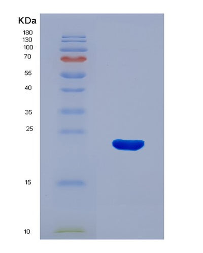 SDS-PAGE analysis of Mouse Strit1 (Sarcoplasmic/Endoplasmic Reticulum Calcium Atpase Regulator Dworf) - Recombinant Protein, CAT# BLT-08267P, showing >90% purity under 15% SDS-PAGE (Reduced)Mouse Strit1 (Sarcoplasmic/Endoplasmic Reticulum Calcium Atpase Regulator Dworf) - Recombinant Protein
