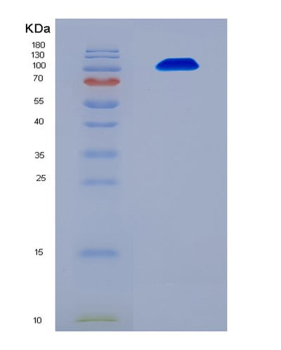 SDS-PAGE analysis of Human UBA1 (Ubiquitin-Like Modifier-Activating Enzyme 1) - Recombinant Protein, CAT# BLT-08268P, showing >90% purity under 15% SDS-PAGE (Reduced)Human UBA1 (Ubiquitin-Like Modifier-Activating Enzyme 1) - Recombinant Protein