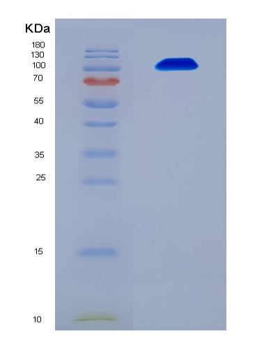 SDS-PAGE analysis of Human UBA1 (Ubiquitin-Like Modifier-Activating Enzyme 1) - Recombinant Protein, CATHuman UBA1 (Ubiquitin-Like Modifier-Activating Enzyme 1) - Recombinant Protein
