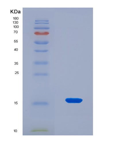 SDS-PAGE analysis of Mouse Hmga1 (High Mobility Group Protein Hmg-I/Hmg-Y) - Recombinant Protein, CAT# BLT-08271P, showing >90% purity under 15% SDS-PAGE (Reduced)Mouse Hmga1 (High Mobility Group Protein Hmg-I/Hmg-Y) - Recombinant Protein