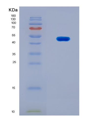SDS-PAGE analysis of Human ACTA2 (Actin, Aortic Smooth Muscle) - Recombinant Protein, CAT# BLT-08274P, showing >90% purity under 15% SDS-PAGE (Reduced)Human ACTA2 (Actin, Aortic Smooth Muscle) - Recombinant Protein