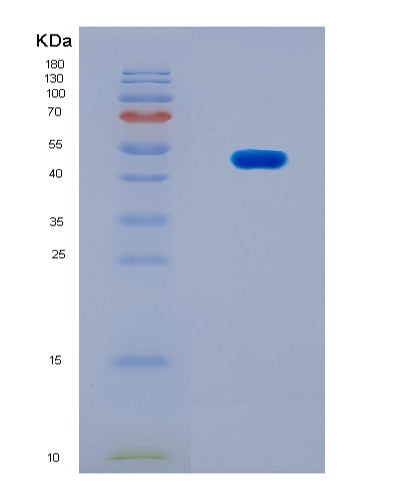 SDS-PAGE analysis of Human ACTA2 (Actin, Aortic Smooth Muscle) - Recombinant Protein, CATHuman ACTA2 (Actin, Aortic Smooth Muscle) - Recombinant Protein