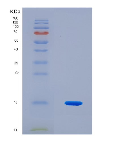 SDS-PAGE analysis of Human FGFR1 (Fibroblast Growth Factor Receptor 1) - Recombinant Protein, CATHuman FGFR1 (Fibroblast Growth Factor Receptor 1) - Recombinant Protein