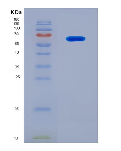 SDS-PAGE analysis of Mouse Mmp2 (72 Kda Type Iv Collagenase) - Recombinant Protein, CAT# BLT-08278P, showing >90% purity under 15% SDS-PAGE (Reduced)Mouse Mmp2 (72 Kda Type Iv Collagenase) - Recombinant Protein