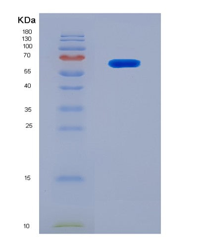 SDS-PAGE analysis of Mouse Mmp2 (72 Kda Type Iv Collagenase) - Recombinant Protein, CATMouse Mmp2 (72 Kda Type Iv Collagenase) - Recombinant Protein