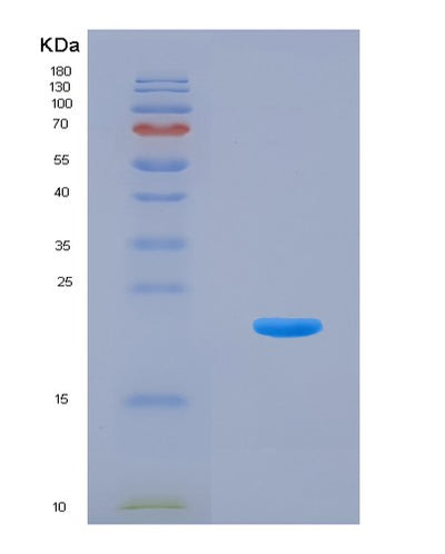 SDS-PAGE analysis of Mouse Il9 (Interleukin-9) - Recombinant Protein, CAT# BLT-08279P, showing >90% purity under 15% SDS-PAGE (Reduced)Mouse Il9 (Interleukin-9) - Recombinant Protein