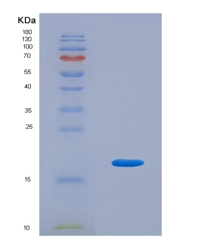 SDS-PAGE analysis of Human IL9 (Interleukin-9) - Recombinant Protein, CATHuman IL9 (Interleukin-9) - Recombinant Protein