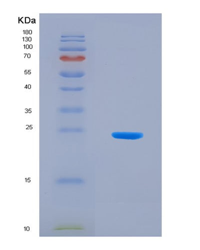 SDS-PAGE analysis of Human SHBG (Sex Hormone-Binding Globulin) - Recombinant Protein, CAT# BLT-08283P, showing >90% purity under 15% SDS-PAGE (Reduced)Human SHBG (Sex Hormone-Binding Globulin) - Recombinant Protein