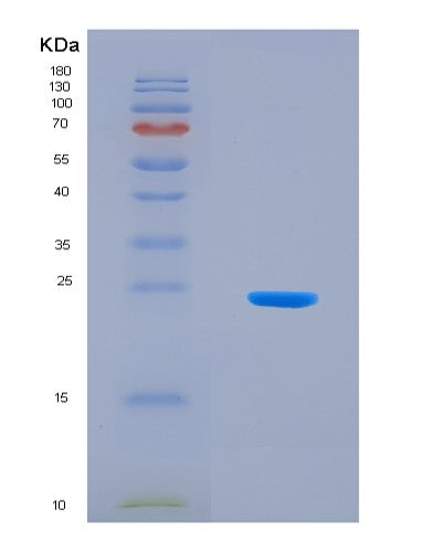 SDS-PAGE analysis of Human SHBG (Sex Hormone-Binding Globulin) - Recombinant Protein, CATHuman SHBG (Sex Hormone-Binding Globulin) - Recombinant Protein