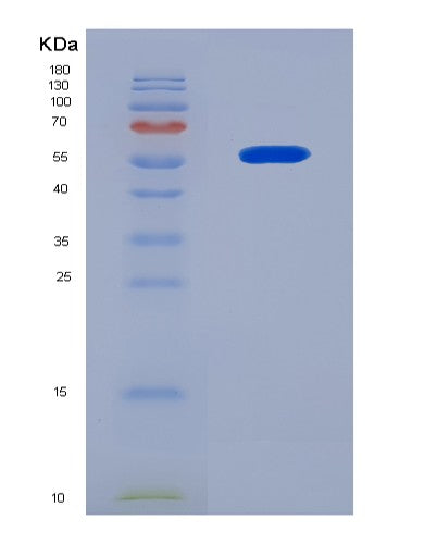 SDS-PAGE analysis of Human CRBN (Protein Cereblon) - Recombinant Protein, CATHuman CRBN (Protein Cereblon) - Recombinant Protein