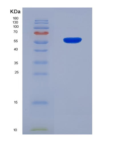 SDS-PAGE analysis of Human CRBN (Protein Cereblon) - Recombinant Protein, CAT# BLT-08286P, showing >90% purity under 15% SDS-PAGE (Reduced)Human CRBN (Protein Cereblon) - Recombinant Protein