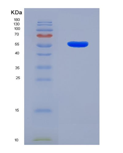 SDS-PAGE analysis of Human CRBN (Protein Cereblon) - Recombinant Protein, CAT# BLT-08287P, showing >90% purity under 15% SDS-PAGE (Reduced)Human CRBN (Protein Cereblon) - Recombinant Protein
