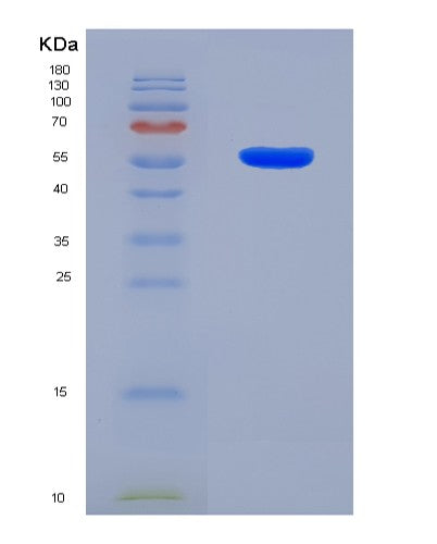 SDS-PAGE analysis of Human CRBN (Protein Cereblon) - Recombinant Protein, CATHuman CRBN (Protein Cereblon) - Recombinant Protein