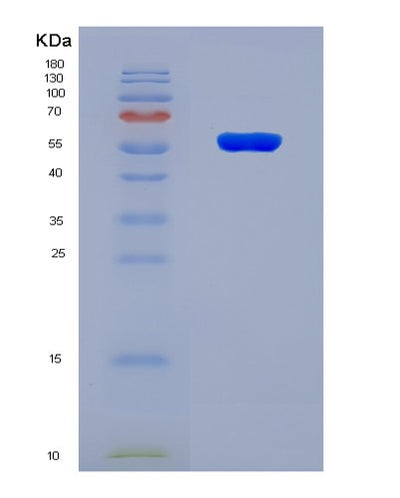 SDS-PAGE analysis of Human CRBN (Protein Cereblon) - Recombinant Protein, CAT# BLT-08289P, showing >90% purity under 15% SDS-PAGE (Reduced)Human CRBN (Protein Cereblon) - Recombinant Protein