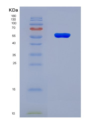 SDS-PAGE analysis of Human CRBN (Protein Cereblon) - Recombinant Protein, CATHuman CRBN (Protein Cereblon) - Recombinant Protein