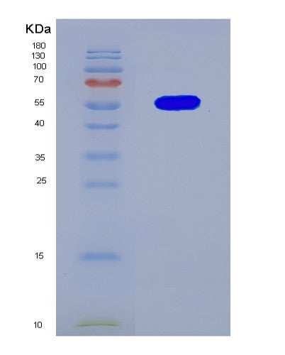 SDS-PAGE analysis of Human CRBN (Protein Cereblon) - Recombinant Protein, CATHuman CRBN (Protein Cereblon) - Recombinant Protein