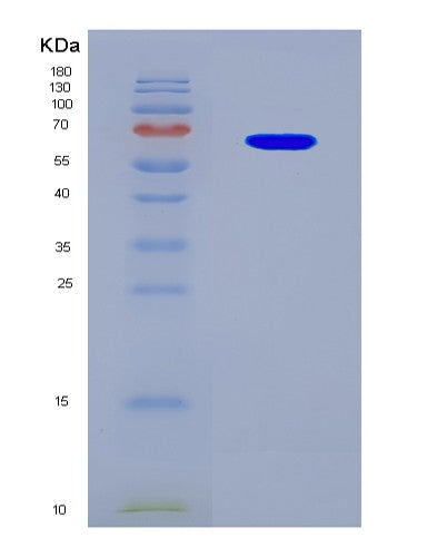 SDS-PAGE analysis of Human YTHDF2 (Yth Domain-Containing Family Protein 2) - Recombinant Protein, CATHuman YTHDF2 (Yth Domain-Containing Family Protein 2) - Recombinant Protein