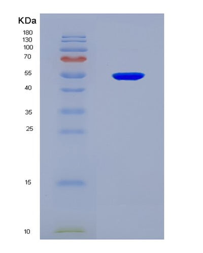 SDS-PAGE analysis of Human AKAP12 (A-Kinase Anchor Protein 12) - Recombinant Protein, CAT# BLT-08292P, showing >90% purity under 15% SDS-PAGE (Reduced)Human AKAP12 (A-Kinase Anchor Protein 12) - Recombinant Protein