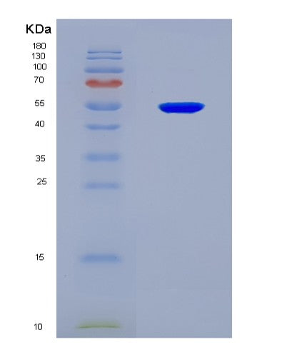 SDS-PAGE analysis of Human AKAP12 (A-Kinase Anchor Protein 12) - Recombinant Protein, CATHuman AKAP12 (A-Kinase Anchor Protein 12) - Recombinant Protein