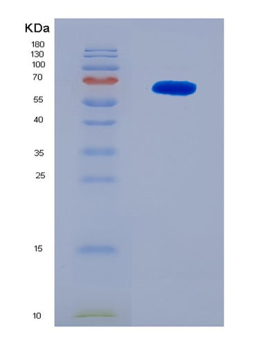 SDS-PAGE analysis of Human RAF1 (Raf Proto-Oncogene Serine/Threonine-Protein Kinase) - Recombinant Protein, CAT# BLT-08293P, showing >90% purity under 15% SDS-PAGE (Reduced)Human RAF1 (Raf Proto-Oncogene Serine/Threonine-Protein Kinase) - Recombinant Protein