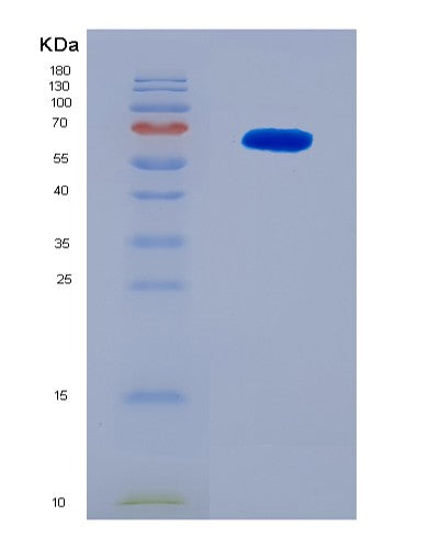 SDS-PAGE analysis of Human RAF1 (Raf Proto-Oncogene Serine/Threonine-Protein Kinase) - Recombinant Protein, CATHuman RAF1 (Raf Proto-Oncogene Serine/Threonine-Protein Kinase) - Recombinant Protein