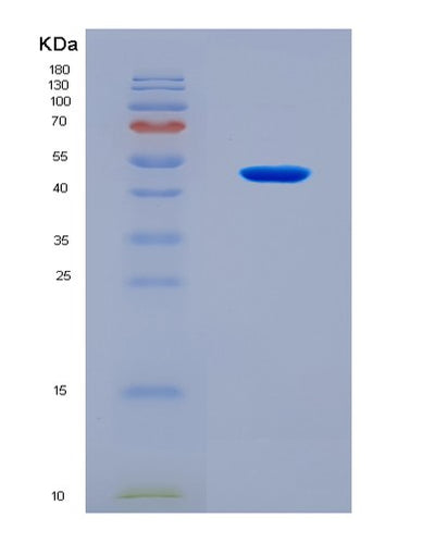 SDS-PAGE analysis of Human WDR4 (Trna (Guanine-N(7)-)-Methyltransferase Non-Catalytic Subunit Wdr4) - Recombinant Protein, CAT# BLT-08294P, showing >90% purity under 15% SDS-PAGE (Reduced)Human WDR4 (Trna (Guanine-N(7)-)-Methyltransferase Non-Catalytic Subunit Wdr4) - Recombinant Protein