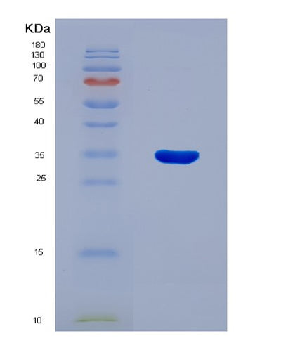 SDS-PAGE analysis of Human AOAH (Acyloxyacyl Hydrolase) - Recombinant Protein, CAT# BLT-08295P, showing >90% purity under 15% SDS-PAGE (Reduced)Human AOAH (Acyloxyacyl Hydrolase) - Recombinant Protein