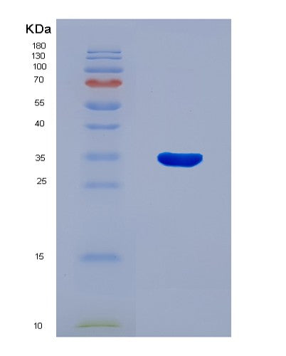 SDS-PAGE analysis of Human AOAH (Acyloxyacyl Hydrolase) - Recombinant Protein, CATHuman AOAH (Acyloxyacyl Hydrolase) - Recombinant Protein