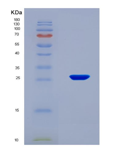SDS-PAGE analysis of Human EPAS1 (Endothelial Pas Domain-Containing Protein 1) - Recombinant Protein, CAT# BLT-08296P, showing >95% purity under 15% SDS-PAGE (Reduced)Human EPAS1 (Endothelial Pas Domain-Containing Protein 1) - Recombinant Protein