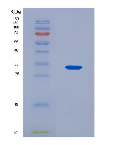 SDS-PAGE analysis of Human ADAM12 (Disintegrin And Metalloproteinase Domain-Containing Protein 12) - Recombinant Protein, CAT# BLT-08299P, showing >90% purity under 15% SDS-PAGE (Reduced)Human ADAM12 (Disintegrin And Metalloproteinase Domain-Containing Protein 12) - Recombinant Protein
