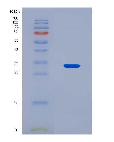 SDS-PAGE analysis of Human ADAM12 (Disintegrin And Metalloproteinase Domain-Containing Protein 12) - Recombinant Protein, CATHuman ADAM12 (Disintegrin And Metalloproteinase Domain-Containing Protein 12) - Recombinant Protein